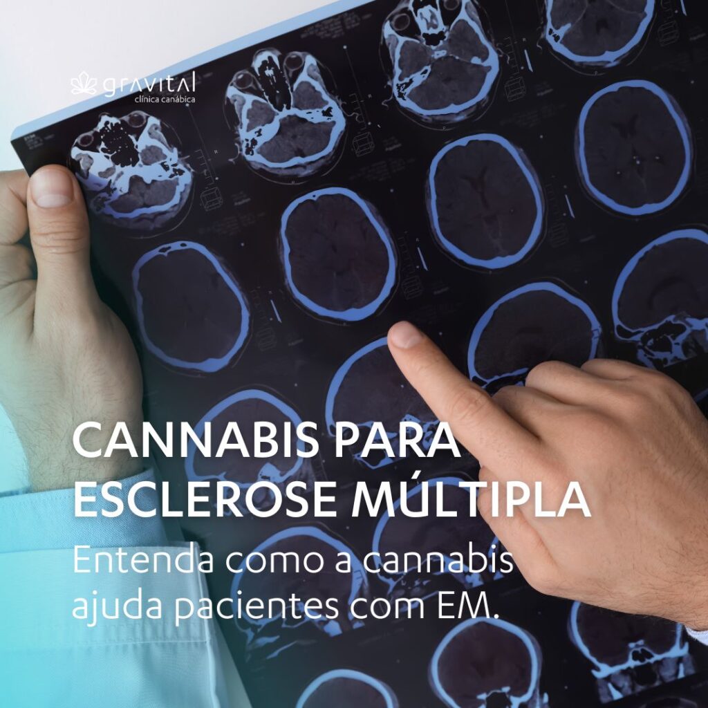 Cannabis para esclerose múltipla. Enetenda os benefícios